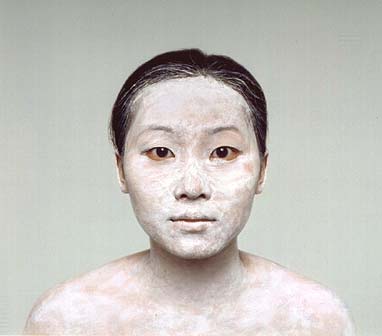 Image from the SKIN exhibit